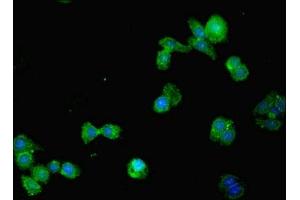 Immunofluorescent analysis of HepG2 cells using ABIN7170849 at dilution of 1:100 and Alexa Fluor 488-congugated AffiniPure Goat Anti-Rabbit IgG(H+L) (MMP1 antibody  (AA 99-476))
