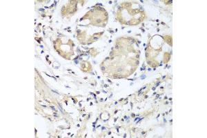 Immunohistochemistry of paraffin-embedded human stomach using NID1 antibody (ABIN5974560) at dilution of 1/100 (40x lens).