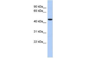 WB Suggested Anti-ZNF566 Antibody Titration:  0. (ZNF566 antibody  (Middle Region))