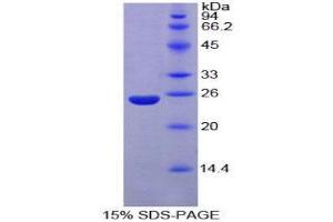 SDS-PAGE (SDS) image for Nucleoporin 160kDa (NUP160) (AA 11-206) protein (His tag) (ABIN1879637)