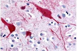 Human Brain, Cortex (formalin-fixed, paraffin-embedded) stained with SLC5A9 antibody ABIN213393 at 10 ug/ml followed by biotinylated goat anti-rabbit IgG secondary antibody ABIN481713, alkaline phosphatase-streptavidin and chromogen. (SLC5A9 antibody  (C-Term))