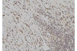 ABIN6261071 and ABIN6277699 at 1/100 staining Human gastric tissue by IHC-P. (CSTA antibody  (C-Term))