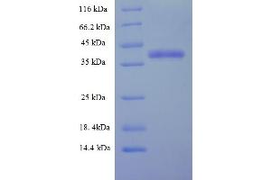 Charged Multivesicular Body Protein 5 (CHMP5) (AA 1-219), (full length) protein (His-SUMO Tag)