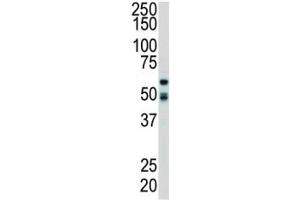 Western Blotting (WB) image for anti-Receptor-Interacting Serine-threonine Kinase 2 (RIPK2) (AA 458-488) antibody (ABIN3032446)