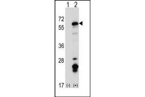 Western blot analysis of Fyn antibody and 293 cell lysate (2 ug/lane) either nontransfected (Lane 1) or transiently transfected (2) with the Fyn gene.