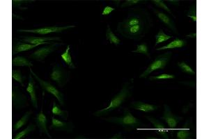Immunofluorescence of purified MaxPab antibody to NLK on HeLa cell. (Nemo-Like Kinase antibody  (AA 1-515))