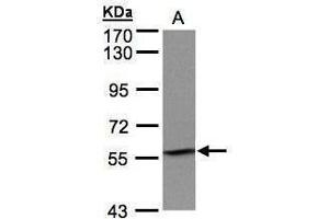 WB Image Sample(30 μg of whole cell lysate) A:H1299 7. (IMPDH2 antibody)