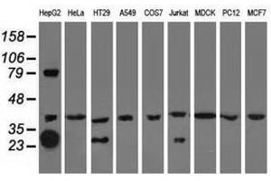 Image no. 1 for anti-Quinolinate Phosphoribosyltransferase (QPRT) antibody (ABIN1500530) (QPRT antibody)