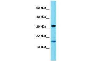 Host: Rabbit Target Name: TREML4 Sample Type: Jurkat Whole Cell lysates Antibody Dilution: 1. (TREML4 antibody  (C-Term))