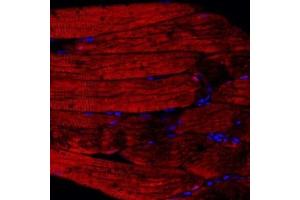 Immunofluorescent analysis of paraffin embedded rat skeletal muscle using PPP2R2C (ABIN7075278) at dilution of 1: 500 (PPP2R2C antibody)