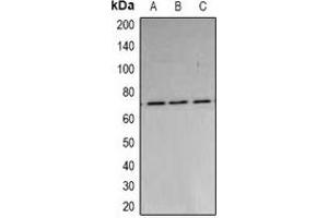 Western blot analysis of PARN expression in A549 (A), MCF7 (B), HepG2 (C) whole cell lysates. (PARN antibody)