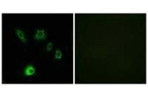 Immunofluorescence analysis of HuvEc cells, using FGF18 antibody. (FGF18 antibody)