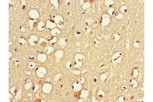 Immunohistochemistry of paraffin-embedded human brain tissue using ABIN7166372 at dilution of 1:100 (ZNF365 antibody  (AA 241-401))