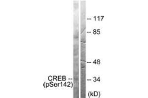 Western blot analysis of extracts from HeLa cells treated with PMA 125ng/ml 30', using CREB (Phospho-Ser142) Antibody. (CREB1 antibody  (pSer142))