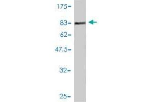 Western Blot detection against Immunogen (77. (GIT2 antibody  (AA 1-471))