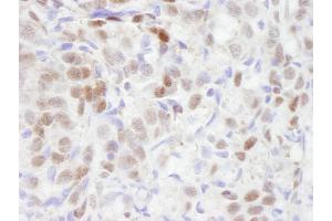 Immunohistochemistry (IHC) image for anti-Transducin (Beta)-Like 1 X-Linked Receptor 1 (TBL1XR1) (AA 100-150) antibody (ABIN7448826) (TBL1XR1 antibody  (AA 100-150))