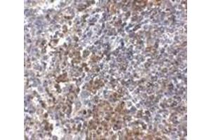 Immunohistochemistry of GPR3 in human spleen tissue with GPR3 antibody at 2. (GPR3 antibody  (C-Term))