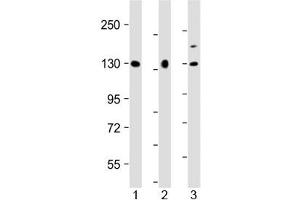 Western blot testing of human 1) U-87 MG, 2) HeLa and 3) BxPC-3 cell lysate with MGEA5 antibody at 1:2000.