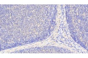 Detection of BCAT1 in Human Lymph node Tissue using Polyclonal Antibody to Branched Chain Aminotransferase 1, Cytosolic (BCAT1) (BCAT1 antibody  (AA 174-386))