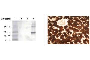 Immunohistochemistry (IHC) image for anti-Cytochrome P450, Family 1, Subfamily A, Polypeptide 2 (CYP1A2) antibody (ABIN264499) (CYP1A2 antibody)