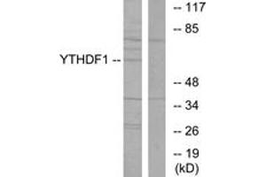 Western blot analysis of extracts from 293 cells, using YTHDF1 Antibody. (YTHDF1 antibody  (AA 1-50))