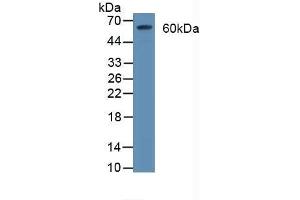 Detection of CD55 in Rat Brain Tissue using Polyclonal Antibody to Cluster Of Differentiation 55 (CD55) (CD55 antibody  (AA 35-285))