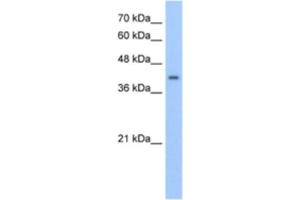 Western Blotting (WB) image for anti-ACC Synthase-Like Protein 1 (ACCS) antibody (ABIN2463243)