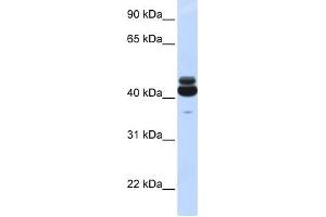GNA15 antibody used at 1 ug/ml to detect target protein. (GNA15 antibody  (N-Term))