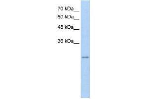 WB Suggested Anti-RFPL3 Antibody Titration:  5. (RFPL3 antibody  (Middle Region))