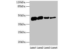 Western blot All lanes: ACTA1 antibody at 16 μg/mL Lane 1: Rat heart tissue Lane 2: Mouse skeletal muscle tissue Lane 3: Human placenta tissue Lane 4: CEM whole cell lysate Secondary Goat polyclonal to rabbit IgG at 1/10000 dilution Predicted band size: 43 kDa Observed band size: 43 kDa