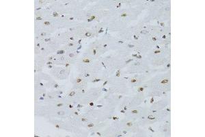 Immunohistochemistry (Paraffin-embedded Sections) (IHC (p)) image for anti-Nuclear Factor of kappa Light Polypeptide Gene Enhancer in B-Cells 2 (NFKB2) (AA 690-899) antibody (ABIN3017388)
