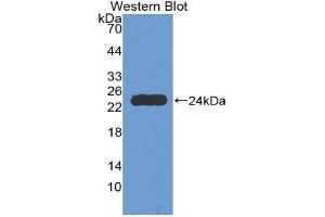 Western Blotting (WB) image for anti-Tumor Necrosis Factor Receptor Superfamily, Member 1A (TNFRSF1A) (AA 248-428) antibody (ABIN1980533) (TNFRSF1A antibody  (AA 248-428))
