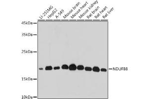 Western blot analysis of extracts of various cell lines, using NDUFB8 antibody (ABIN7268814) at 1:500 dilution. (NDUFB8 antibody)