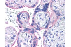Immunohistochemistry (IHC) image for anti-Insulin Receptor (INSR) (Middle Region) antibody (ABIN2792204) (Insulin Receptor antibody  (Middle Region))