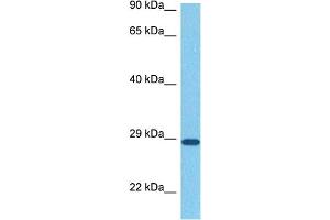 Host:  Rabbit  Target Name:  SNAI1  Sample Tissue:  Human Stomach Tumor  Antibody Dilution:  1ug/ml (SNAIL antibody  (N-Term))