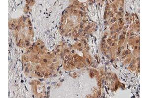 Immunohistochemical staining of paraffin-embedded Human Kidney tissue using anti-DNAJA2 mouse monoclonal antibody. (DNAJA2 antibody)