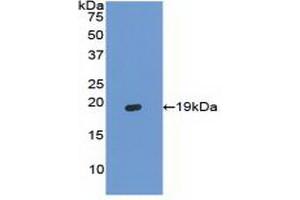 Detection of Recombinant HBa1, Bovine using Polyclonal Antibody to Hemoglobin Alpha 1 (HBa1) (HBA1 antibody  (AA 2-142))