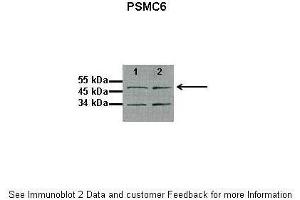 Lanes:  1: 10ug proteasome fraction from C57B1/6J mouse brain, 2: 10ug proteasome fraction from BLAB/C mouse brain Primary Antibody Dilution:  1:500 Secondary Antibody:  Anti-rabbit HRP Secondary Antibody Dilution:  1:5000 Gene Name:  PSMC6 Submitted by:  Dr. (PSMC6 antibody  (C-Term))