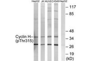 Western blot analysis of extracts from HepG2 cells, Jurkat cells, HuvEc cells and A549 cells, using Cyclin H (Phospho-Thr315) Antibody.