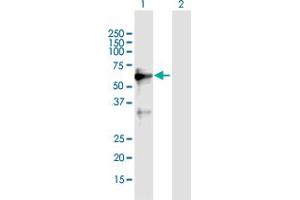 Western Blot analysis of ZNF554 expression in transfected 293T cell line by ZNF554 MaxPab polyclonal antibody.