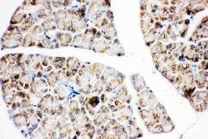Anti-IGF1 Receptor antibody, IHC(P) IHC(P): Rat Pancreas Tissue