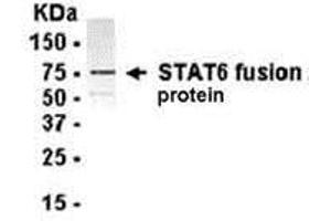 Western Blotting (WB) image for anti-Signal Transducer and Activator of Transcription 6, Interleukin-4 Induced (STAT6) (AA 61-275) antibody (ABIN2468153) (STAT6 antibody  (AA 61-275))