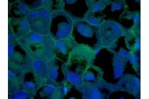 Immunofluorescence (IF) image for anti-Tight Junction Protein 1 (TJP1) (C-Term) antibody (ABIN6254231)