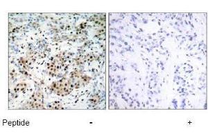 Image no. 1 for anti-cAMP Responsive Element Binding Protein 1 (CREB1) (Ser133) antibody (ABIN197188) (CREB1 antibody  (Ser133))