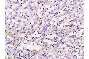 Immunohistochemistry (Paraffin-embedded Sections) (IHC (p)) image for anti-Adenylate Cyclase 10 (Soluble) (ADCY10) (AA 1101-1200) antibody (ABIN751093)