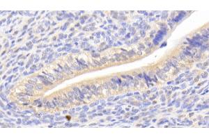Detection of CA125 in Mouse Uterus Tissue using Polyclonal Antibody to Carbohydrate Antigen 125 (CA125) (MUC16 antibody  (AA 2-258))