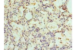 Immunohistochemistry of paraffin-embedded human lung tissue using ABIN7143352 at dilution of 1:100