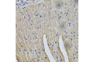 Immunohistochemistry of paraffin-embedded rat heart using HMGCR Antibody (ABIN6293217) at dilution of 1:100 (40x lens).