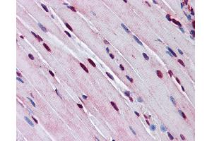 Anti-TTF1 antibody IHC of mouse skeletal muscle.