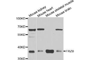 Western blot analysis of extracts of various cell lines, using FRZB antibody (ABIN5973961) at 1/1000 dilution. (FRZB antibody)